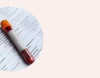Dagnostika endometrioze - krvni test
