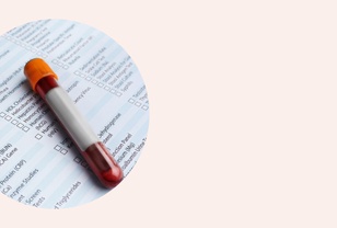 Dagnostika endometrioze - krvni test