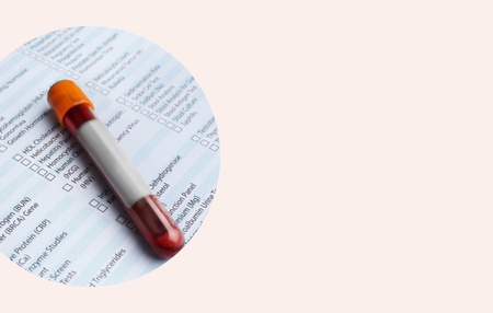 Dagnostika endometrioze - krvni test